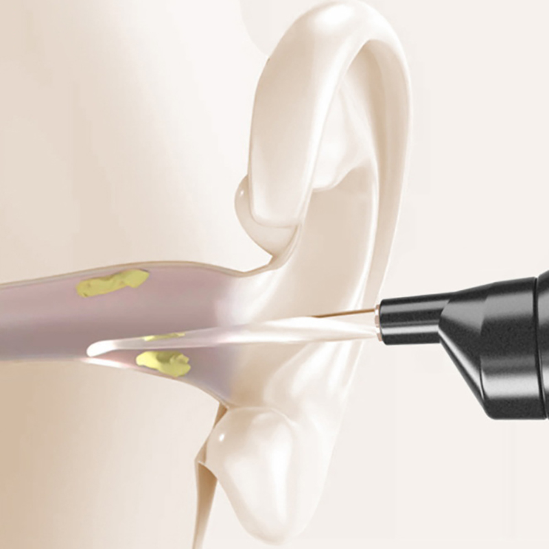 Electric Vacuum Ear Wax Remove - Ear Wax Remover review and price