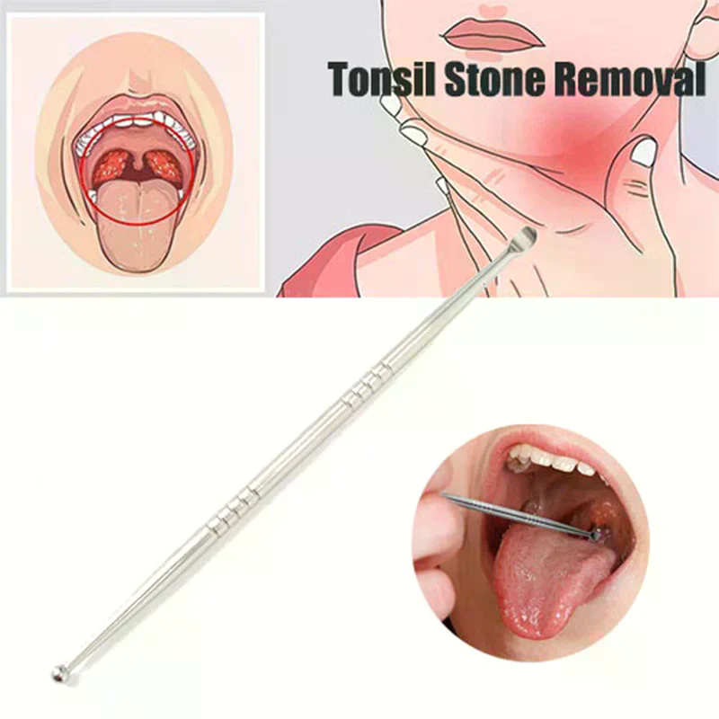 1pc Remover Tool Stainless Ton - Ear Wax Remover review and price